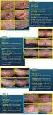 N/DERM